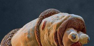 Micro Animals – Images Taken Under Microscope
